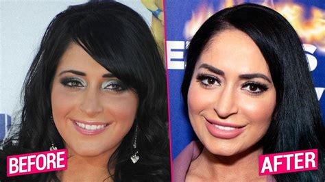 angelina pivarnick acne|Jersey Shore: Angelina Pivarnick Plastic Surgery。